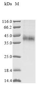 Recombinant Rat Asialoglycoprotein receptor 1 (Asgr1), partial