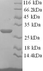 Recombinant Mouse Asialoglycoprotein receptor 1 (Asgr1), partial, Mus musculus (Mouse), Yeast, N-terminal 6xHis-tagged, 27.8kDa, purity >90% as determined by SDS-PAGE.