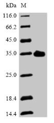 Recombinant Mouse Asialoglycoprotein receptor 2 (Asgr2), partial