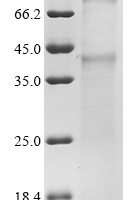 (Tris-Glycine gel) Discontinuous SDS-PAGE (reduced) with 5% enrichment gel and 15% separation gel.