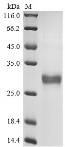 Recombinant Necator americanus Ancylostoma secreted protein 2 (ASP2)