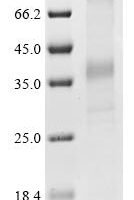 (Tris-Glycine gel) Discontinuous SDS-PAGE (reduced) with 5% enrichment gel and 15% separation gel.
