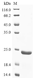 Recombinant African swine fever virus Inner membrane protein p54 (Ba71V-126), partial