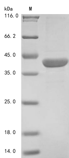 Recombinant Arabidopsis thaliana Beta-amylase 1, chloroplastic (BAM1), partial