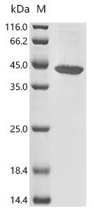 Recombinant Mouse Adiponectin receptor protein 1 (Adipor1) Protein, Mus musculus (Mouse), in vitro E.coli expression system, N-terminal 10xHis-tagged, 43.9kDa, purity >85% as determined by SDS-PAGE.