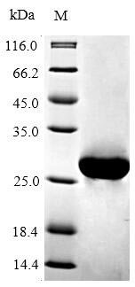 Recombinant Mouse Apoptosis regulator Bcl-2 (Bcl2), partial, Mus musculus (Mouse), E.coli, N-terminal 6xHis-tagged, 26.7kDa, purity >90% as determined by SDS-PAGE.