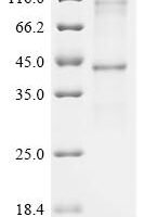 (Tris-Glycine gel) Discontinuous SDS-PAGE (reduced) with 5% enrichment gel and 15% separation gel.