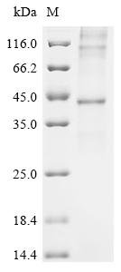 Recombinant Mouse C-C chemokine receptor type 2 (Ccr2) Protein, Mus musculus (Mouse), in vitro E.coli expression system, N-terminal 10xHis-tagged, 44.3kDa, purity >90% as determined by SDS-PAGE.