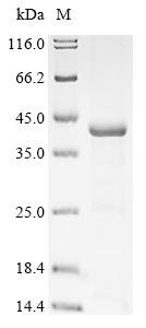 Recombinant Gossypium hirsutum Non-specific serine/threonine protein kinase (BIN2)