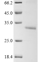 (Tris-Glycine gel) Discontinuous SDS-PAGE (reduced) with 5% enrichment gel and 15% separation gel.