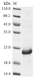 Recombinant Mouse Baculoviral IAP repeat-containing protein 5 (Birc5)