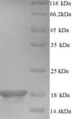 Recombinant Mouse Baculoviral IAP repeat-containing protein 5 (Birc5)