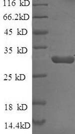 Recombinant Escherichia coli Beta-lactamase CTX-M-1 (bla)