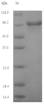Recombinant Epstein-Barr virus Envelope glycoprotein GP350 (BLLF1), partial