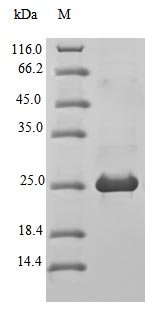 Recombinant Mouse Bloom syndrome protein homolog (Blm), partial, Mus musculus (Mouse), E.coli, N-terminal 10xHis-tagged and C-terminal MYC-tagged, 24.7kDa, purity >90% as determined by SDS-PAGE.