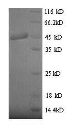 Recombinant Clostridium botulinum Botulinum neurotoxin type B (botB), partial