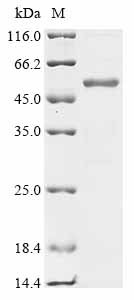 Recombinant Clostridium botulinum Botulinum neurotoxin type E (botE), partial