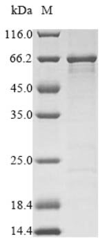 Recombinant Clostridium botulinum Botulinum neurotoxin type F (botF), partial