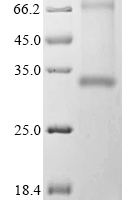 (Tris-Glycine gel) Discontinuous SDS-PAGE (reduced) with 5% enrichment gel and 15% separation gel.