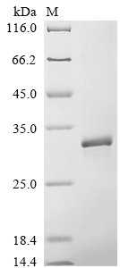 Recombinant Hepatitis B virus genotype A2 subtype adw2 Capsid protein (C)