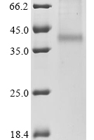 (Tris-Glycine gel) Discontinuous SDS-PAGE (reduced) with 5% enrichment gel and 15% separation gel.