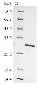 Recombinant Hepatitis B virus genotype A2 subtype adw2 Capsid protein (C), Hepatitis B virus genotype A2 subtype adw2 (strain Rutter 1979) (HBV-A), E.coli, N-terminal 6xHis-tagged, 25.4kDa, purity >85% as determined by SDS-PAGE.