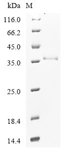 Recombinant Hepatitis B virus genotype A2 subtype adw2 Capsid protein (C), Hepatitis B virus genotype A2 subtype adw2 (strain Rutter 1979) (HBV-A), E.coli, N-terminal 6xHis-SUMO-tagged, 34.3kDa, purity >90% as determined by SDS-PAGE.