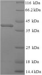 Recombinant Mouse Complement C1q subcomponent subunit A (C1qa), Mus musculus (Mouse), E.coli, N-terminal 6xHis-SUMO-tagged, 39.6kDa, purity >90% as determined by SDS-PAGE.