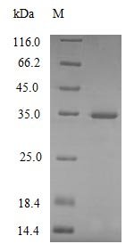 Recombinant Mouse Complement C1q subcomponent subunit A (C1qa), Mus musculus (Mouse), E.coli, N-terminal 6xHis-tagged, 29.1kDa, purity >85% as determined by SDS-PAGE.