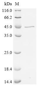 Recombinant Mouse Complement C1q subcomponent subunit B (C1qb), Biotinylated, Mus musculus (Mouse), E.coli, N-terminal 6xHis-SUMO3-Avi-tagged, 37.7kDa, purity >85% as determined by SDS-PAGE.