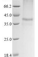 (Tris-Glycine gel) Discontinuous SDS-PAGE (reduced) with 5% enrichment gel and 15% separation gel.
