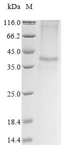 Recombinant Mouse Zinc transporter 8 (Slc30a8) Protein, Mus musculus (Mouse), in vitro E.coli expression system, N-terminal 10xHis-tagged, 43.0kDa, purity >85% as determined by SDS-PAGE.