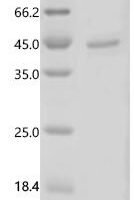 (Tris-Glycine gel) Discontinuous SDS-PAGE (reduced) with 5% enrichment gel and 15% separation gel.