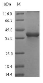 Recombinant Bovine Complement C3 (C3), partial