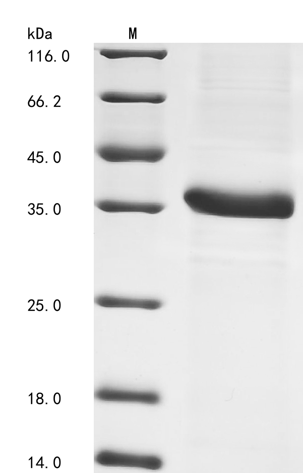 Recombinant Mouse Complement C4-B (C4b), partial, Mus musculus (Mouse), E.coli, N-terminal 6xHis-tagged, 39.0kDa, purity >90% as determined by SDS-PAGE.