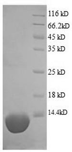 Recombinant Pig Complement C5a anaphylatoxin (C5)