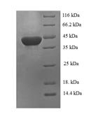 Recombinant Rat Carbonic anhydrase 1 (Ca1)