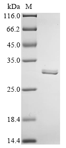 Recombinant Rat Carbonic anhydrase 2 (Ca2)