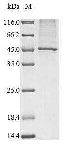 Recombinant Saccharomyces cerevisiae Serine/threonine-protein kinase CAK1 (CAK1)