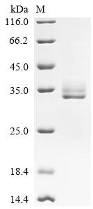 Recombinant Mouse Calcitonin gene-related peptide 1 (Calca), partial, Mus musculus (Mouse), Mammalian cell, N-terminal hFc-tagged, 29.9kDa, purity >95% as determined by SDS-PAGE.