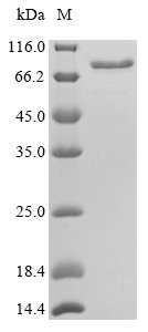 Recombinant Mouse Calreticulin (Calr), Mus musculus (Mouse), E.coli, N-terminal GST-tagged, 73.3kDa, purity >90% as determined by SDS-PAGE.