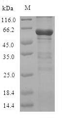 Recombinant Mouse Cystathionine beta-synthase (Cbs)