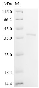 Recombinant Mouse Coiled-coil domain-containing protein 3 (Ccdc3)