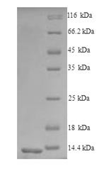 Recombinant Mouse C-C chemokine receptor type 5 (Ccr5), partial, Mus musculus (Mouse), Yeast, N-terminal 6xHis-tagged, 12.6kDa, purity >95% as determined by SDS-PAGE.
