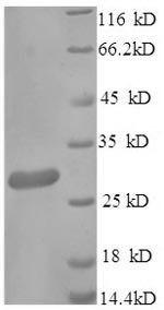 Recombinant Mouse Scavenger receptor cysteine-rich type 1 protein M130 (Cd163), partial, Mus musculus (Mouse), E.coli, N-terminal 6xHis-tagged, 34.2kDa, purity >90% as determined by SDS-PAGE.