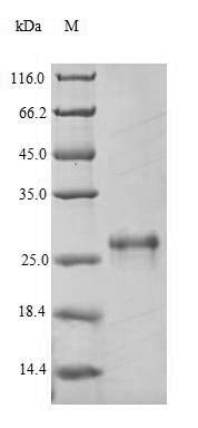 Recombinant Mouse Scavenger receptor cysteine-rich type 1 protein M130 (Cd163), partial, Mus musculus (Mouse), Yeast, N-terminal 6xHis-tagged, 32.2kDa, purity >90% as determined by SDS-PAGE.