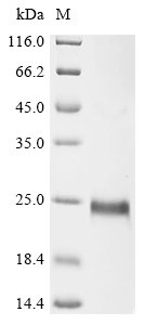 Recombinant Mesocricetus auratus CD27 antigen (Cd27), partial, Mesocricetus auratus (Golden hamster), E.coli, N-terminal 6xHis-tagged and C-terminal Strep II-tagged, 20.5kDa, purity >90% as determined by SDS-PAGE.