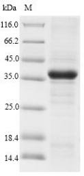 Recombinant Rat CMRF35-like molecule 1 (Cd300lf), partial, Rattus norvegicus (Rat), E.coli, N-terminal 10xHis-SUMO-tagged and C-terminal Myc-tagged, 38.3kDa, purity >90% as determined by SDS-PAGE.