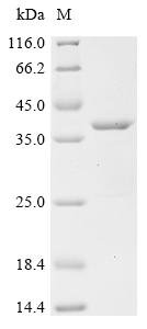 Recombinant Mouse CD81 antigen (Cd81), partial, Mus musculus (Mouse), E.coli, N-terminal 6xHis-GST-tagged, 40.9kDa, purity >90% as determined by SDS-PAGE.