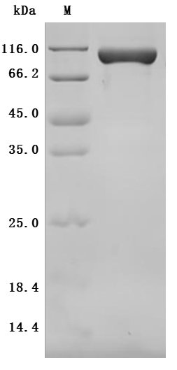 Recombinant Mouse CUB domain-containing protein 1 (Cdcp1), partial (Active), Mus musculus (Mouse), Mammalian cell, C-terminal 10xHis-tagged, 73.2kDa, purity >95% as determined by SDS-PAGE.